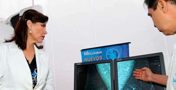 Mamógrafos para detectar cáncer a tiempo