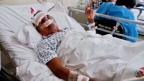 reconstruyen nariz mordida por un asno de un adulto mayor