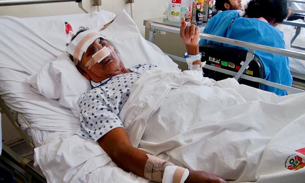 reconstruyen nariz mordida por un asno de un adulto mayor