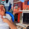 Letrero de peluquería cae sobre mujer de 83 años en Nuevo Chimbote