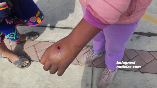 La uta reaparece en Pallasca y denuncian que no hay ampollas.