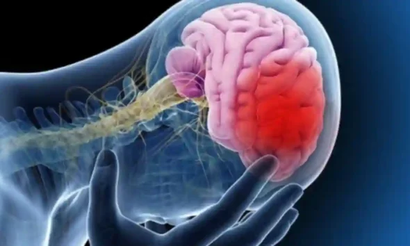 Ataque cerebrovascular: causas, consecuencias y cómo actuar