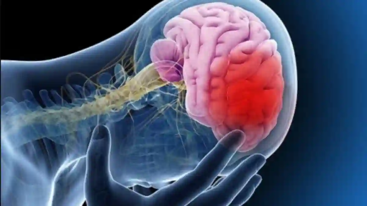 Ataque cerebrovascular: causas, consecuencias y cómo actuar