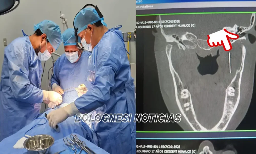 Adolescente se salva tras cirugía que sacó aguja cerca del cráneo