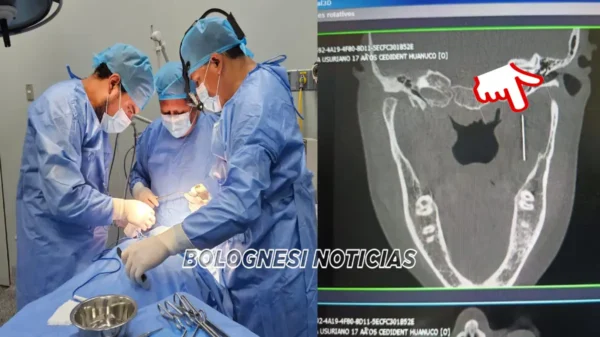 Adolescente se salva tras cirugía que sacó aguja cerca del cráneo