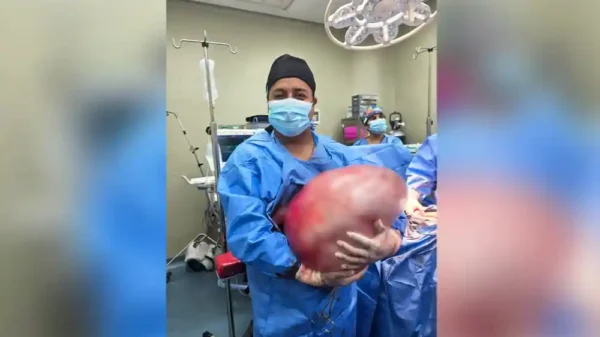 Proeza médica en el Hospital San José del Callao extirpan tumor de 25 Kg. a joven