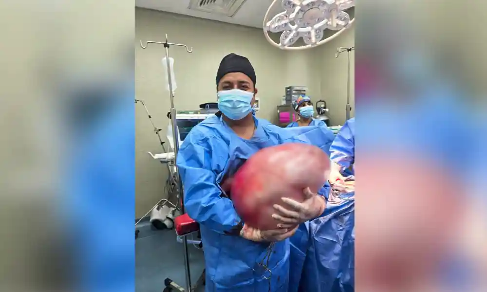 Proeza médica en el Hospital San José del Callao extirpan tumor de 25 Kg. a joven